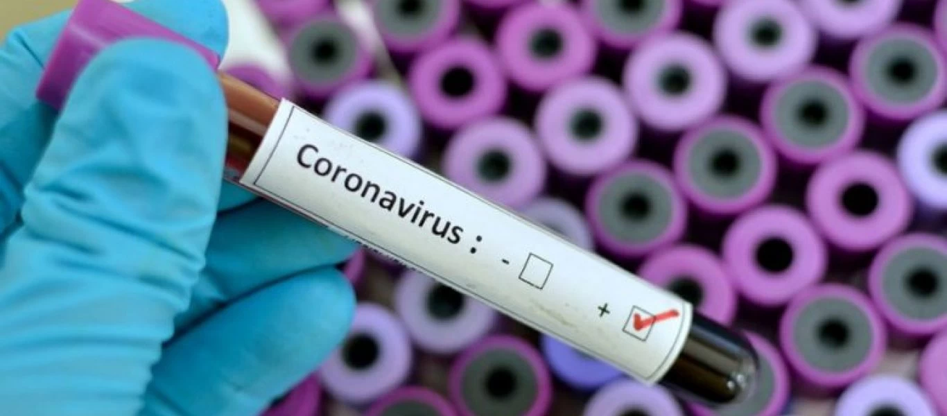 Ζοφερή πρόβλεψη μικροβιολόγου: «Ο ιός θα επιστρέψει πιο επιθετικός τον χειμώνα»